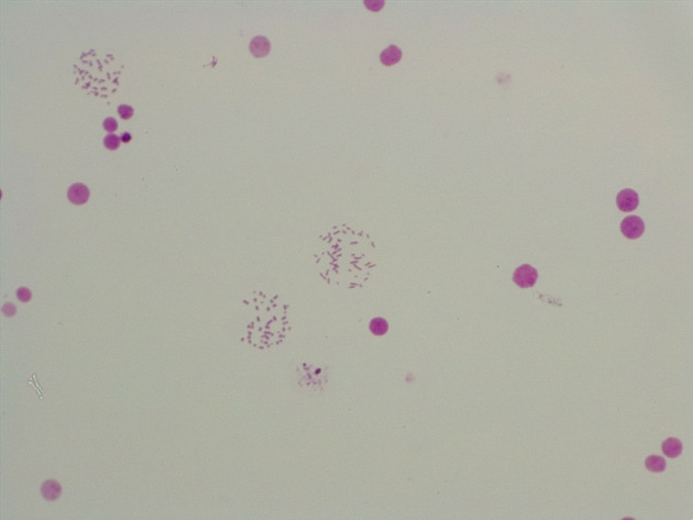 Female Chromosomes Slides - Female Chromosomes 06 200X